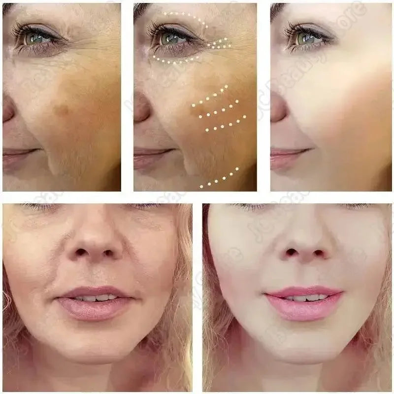 Whitening Capsules Tightening Capsules Anti-Aging Skin Care by Dropshee