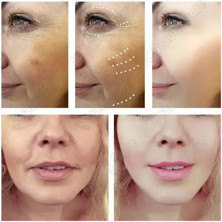 Whitening Capsules Tightening Capsules - GiFTiFY