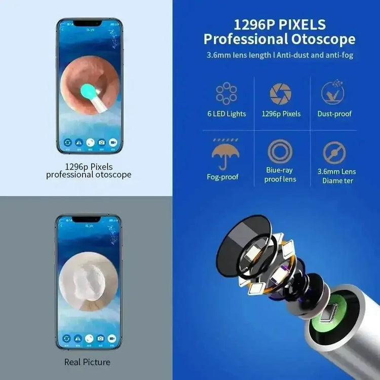 Wireless Ear Cleaning Mobile phone Link Camera LED light Wireless Ear Endoscope Earwax Cleaning - GiFTiFY