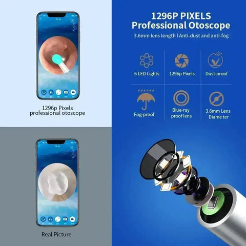 Wireless Ear Cleaning Mobile phone Link Camera LED light Wireless Ear Endoscope Earwax Cleaning - GiFiFY